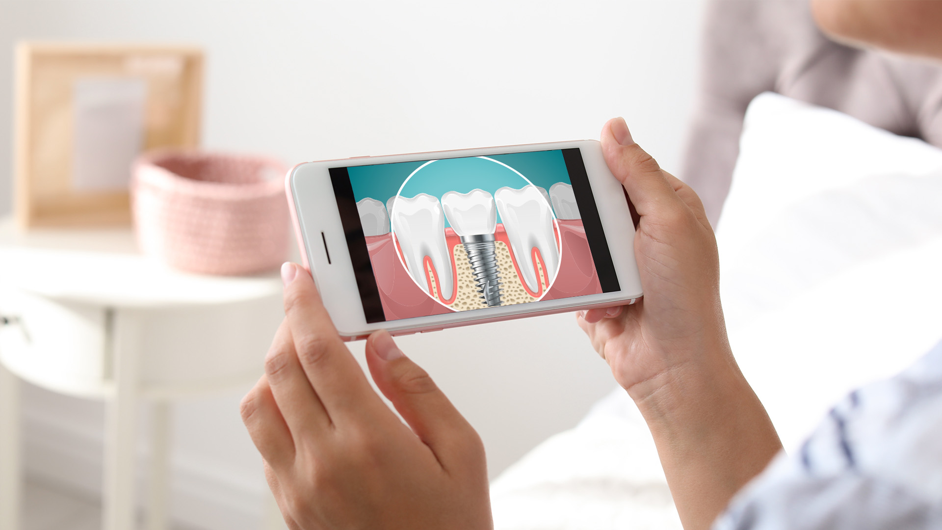 A person holding a smartphone displaying an image of a tooth with a dental implant.
