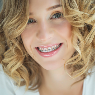 The image shows a woman with straight teeth, wearing braces, smiling at the camera, with blond hair styled in loose curls, against a white background.