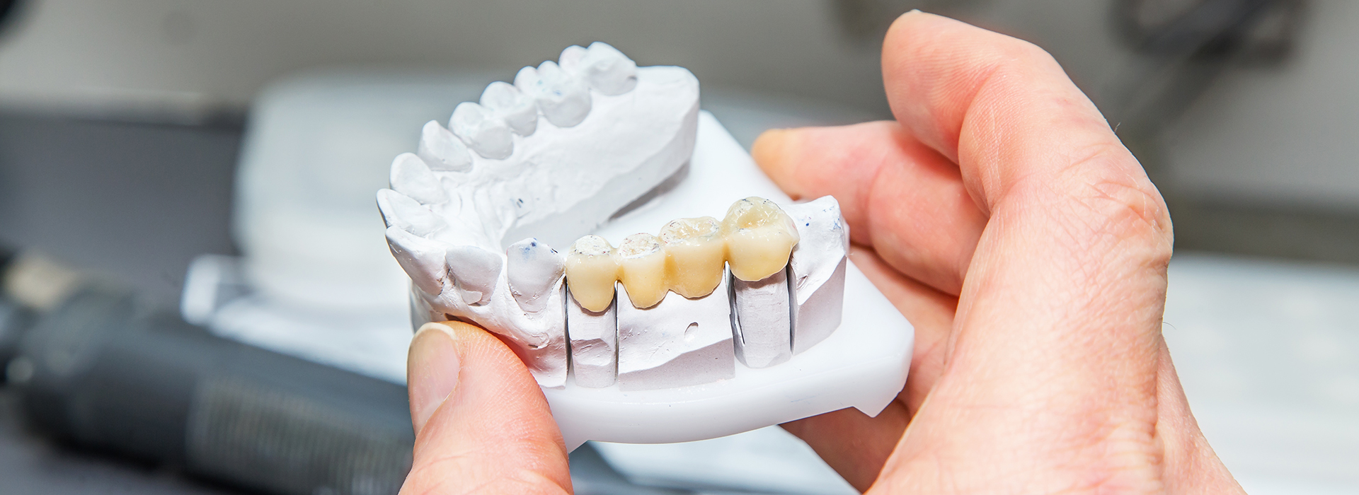 The image shows a person holding a set of white teeth models with visible tooth enamel and roots, likely used for dental education or demonstration purposes.