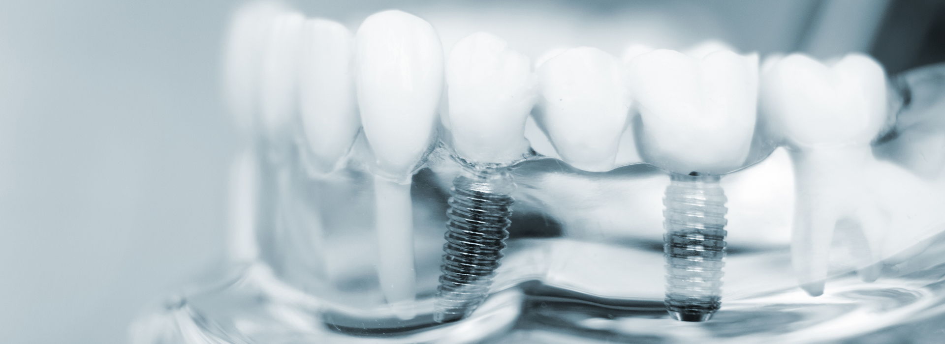 The image shows a close-up view of several toothbrush bristles with white bristle tips against a blurred background, emphasizing dental hygiene products.