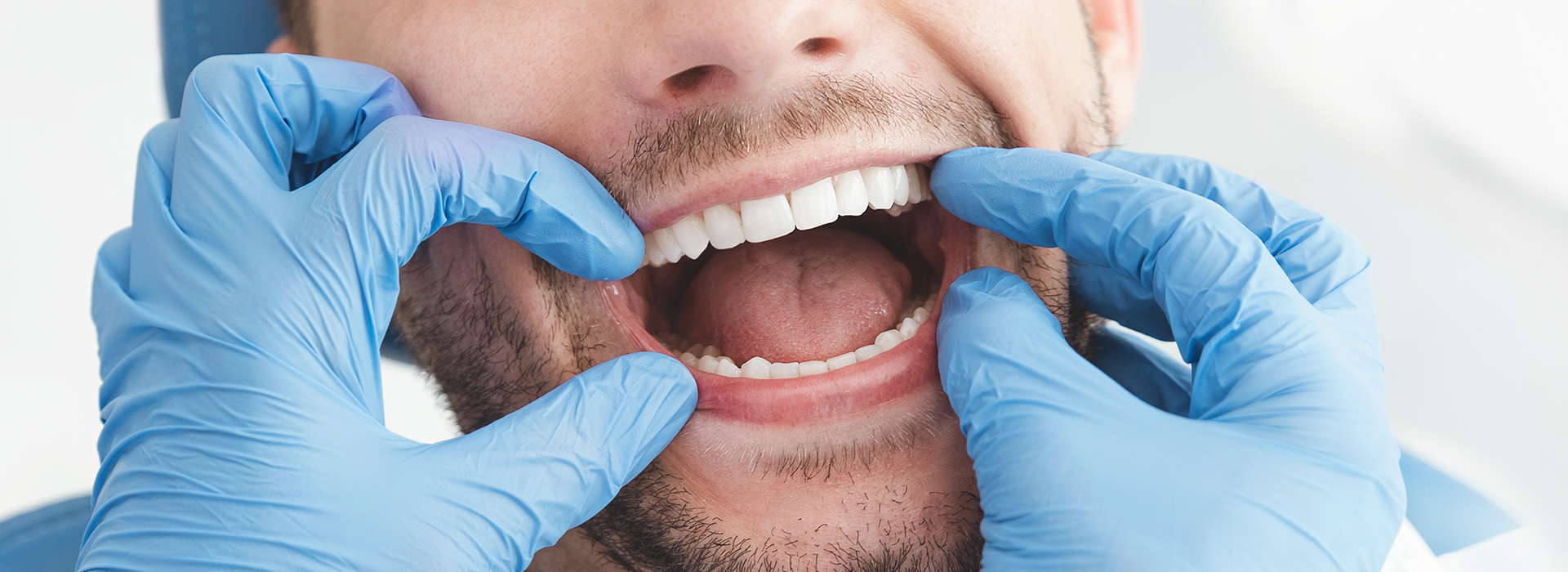 A man with his mouth wide open, wearing blue gloves, likely a dental professional, in front of a white background.