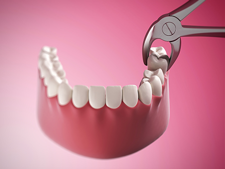 The image shows a pair of scissors with a red handle cutting into a set of white teeth within a pink mouth, which appears to be part of a dental appliance or model.